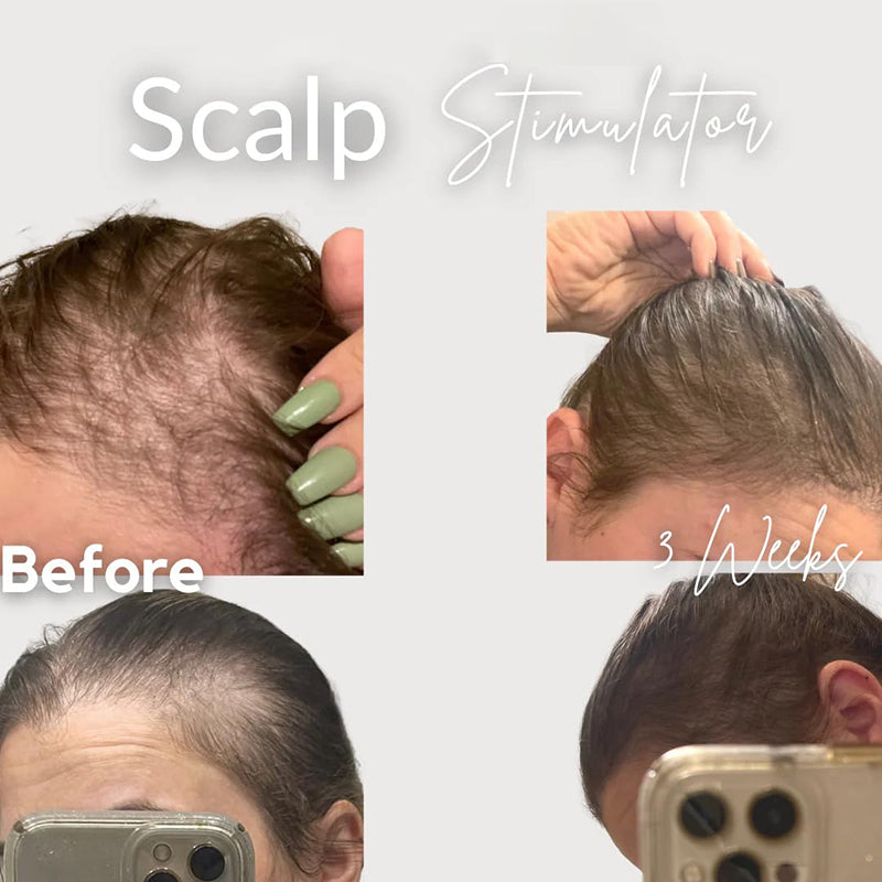 Scalp Stimulation – Tratament Natural pentru Creșterea și Regenerarea Părului